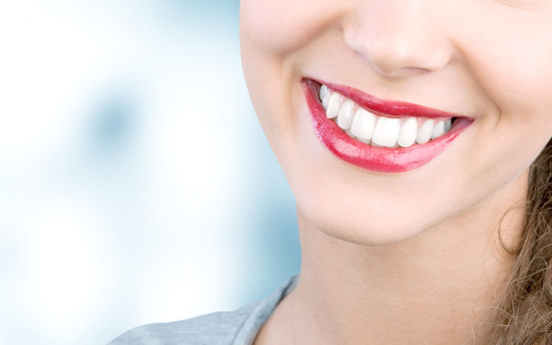 Λεύκανση Δοντιών – Πριν και Μετά